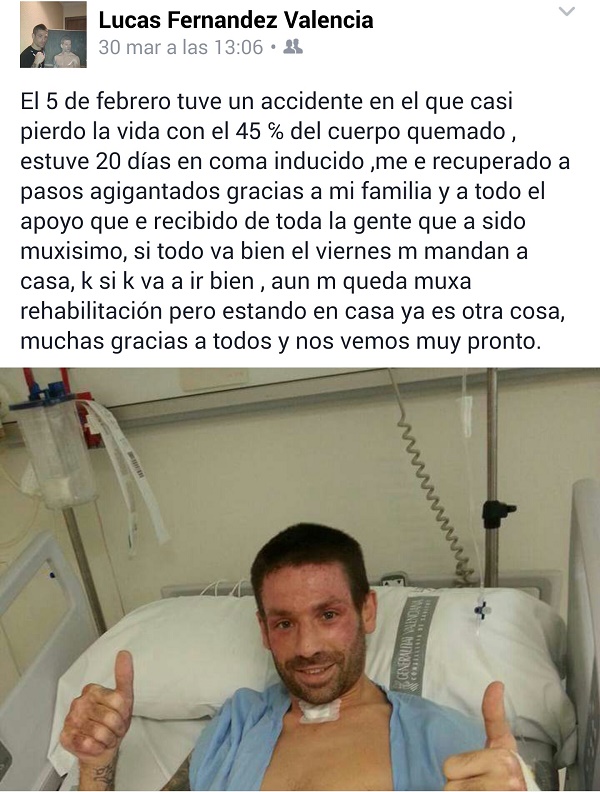 Fernandez-Lucas